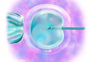 上海試管嬰兒費用如何？哪些人群適合做試管嬰兒？