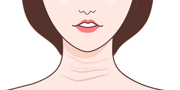 去頸紋比較好的方法是什么？去做什么項目會比較好？