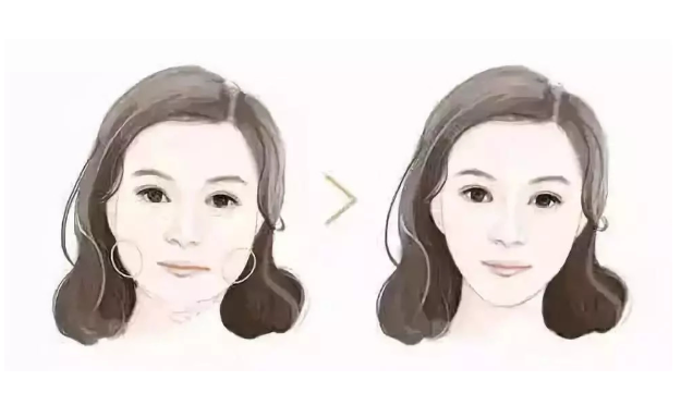 上海熱瑪吉哪家好？費(fèi)用多少？能維持多久？