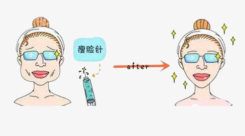 在鄭州去公立醫(yī)院打瘦臉針好，還是私立醫(yī)院好？