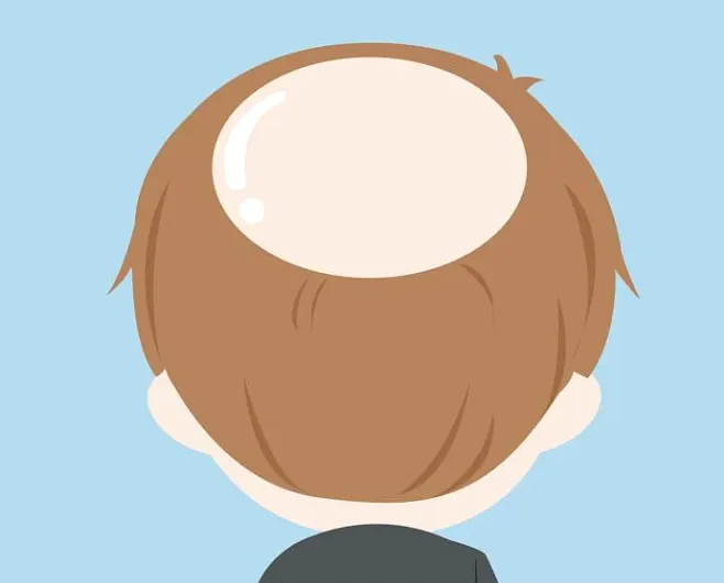 脫發(fā)該知道哪些小知識？