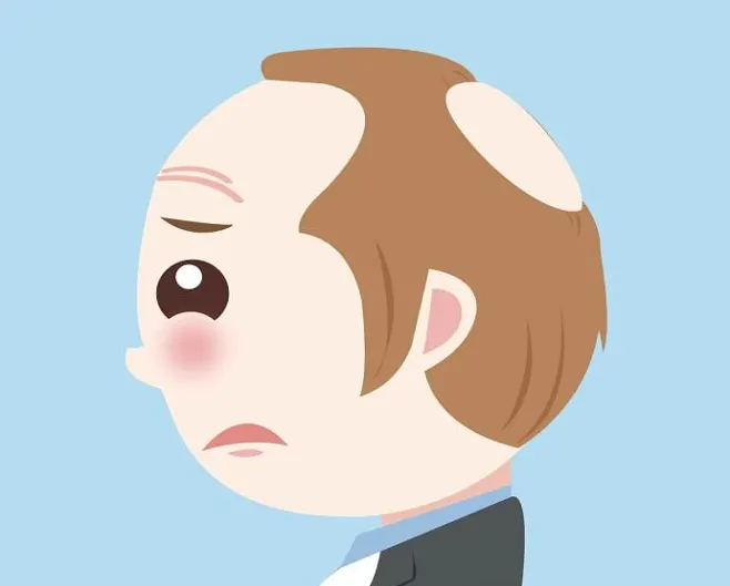 脫發(fā)該知道哪些小知識？