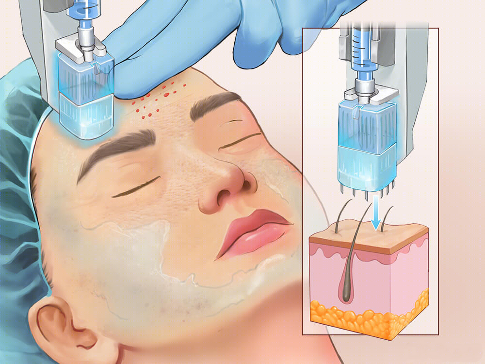 中國機(jī)打水光前50名整形醫(yī)院不踩雷大推薦！