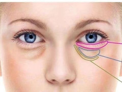 蘇州市消眼袋整形醫(yī)生實(shí)力排行！建議收藏