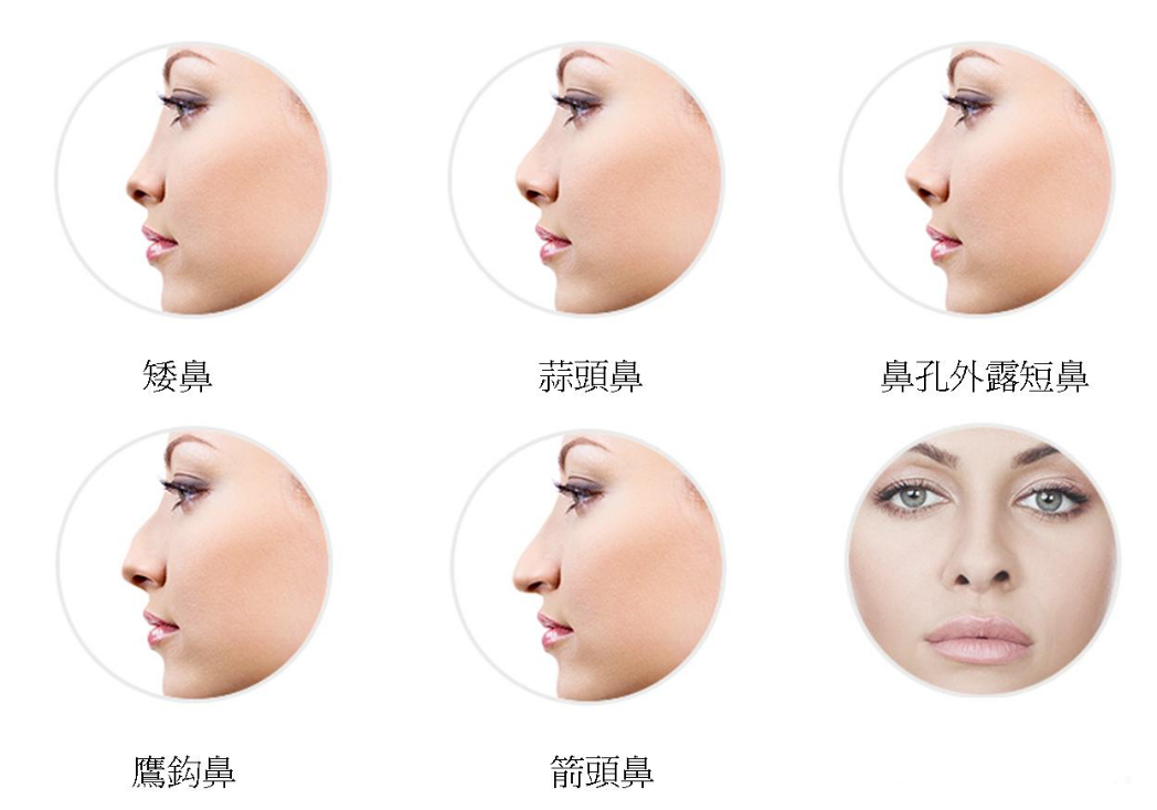 蚌埠市自體脂肪注射隆鼻整形醫(yī)院紅榜大盤點！