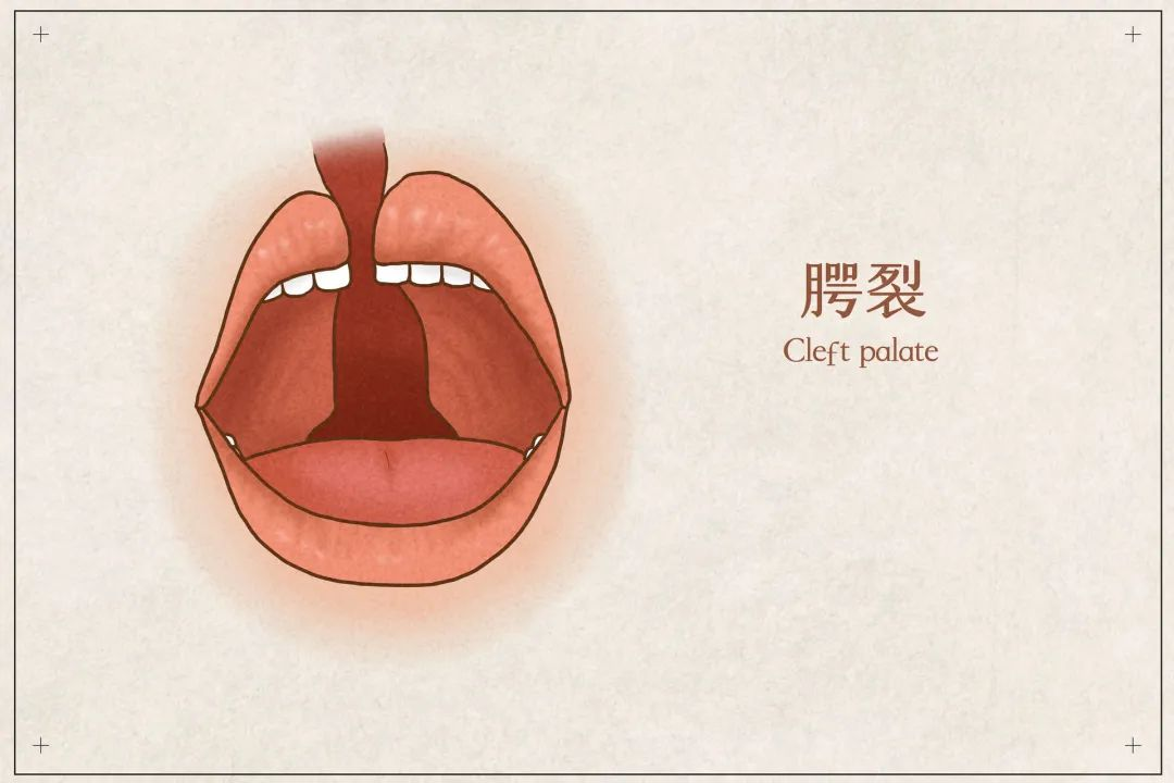 遵義市唇腭裂手術(shù)矯正這五位醫(yī)生實(shí)力出眾！