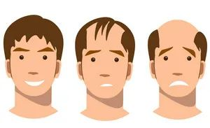 大同市毛發(fā)種植認(rèn)準(zhǔn)這幾家醫(yī)院準(zhǔn)沒錯！