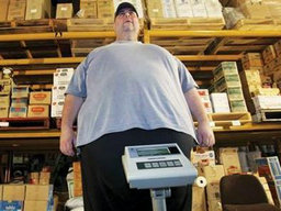 肥胖癥手術治療指征