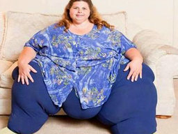 肥胖癥主要的發(fā)病原因是什么