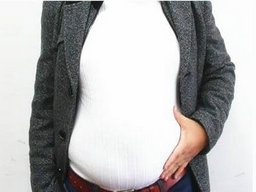 肥胖癥治療方法有哪些